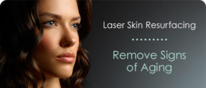 smartskin-laser-skin-resurfacing