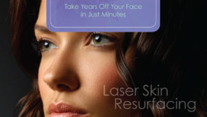 smartskin-laser-skin-resurfacing-cincinnati