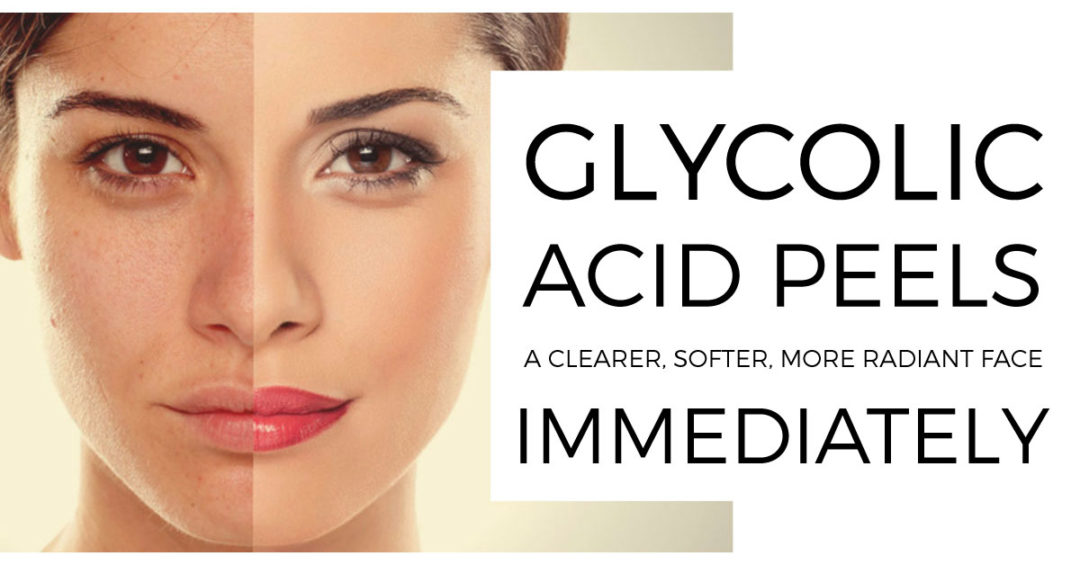 GLYCOLICACIDPEELS Vigour